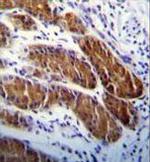 ATG5 Antibody in Immunohistochemistry (Paraffin) (IHC (P))