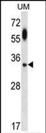 ATG5 Antibody in Western Blot (WB)