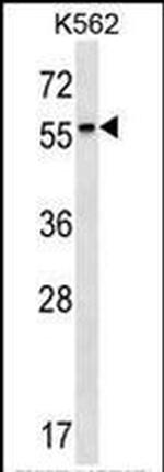 RARB Antibody in Western Blot (WB)