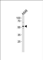 ZKSCAN4 Antibody in Western Blot (WB)