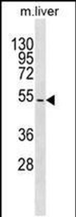 TBX15 Antibody in Western Blot (WB)