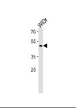 TFDP3 Polyclonal Antibody