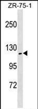 ZHX2 Antibody in Western Blot (WB)