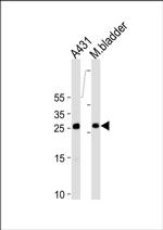 14-3-3 sigma Antibody in Western Blot (WB)