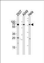 HSF2 Antibody in Western Blot (WB)