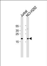 TAF10 Antibody in Western Blot (WB)
