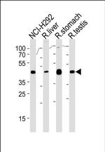 PCGF6 Antibody in Western Blot (WB)