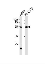 TBX4 Antibody in Western Blot (WB)