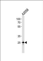 MRPL28 Antibody in Western Blot (WB)