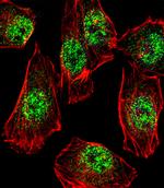 RHOXF2B Polyclonal Antibody