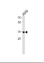 RHOXF2B Antibody in Western Blot (WB)