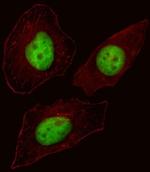 FOXN3 Antibody in Immunocytochemistry (ICC/IF)