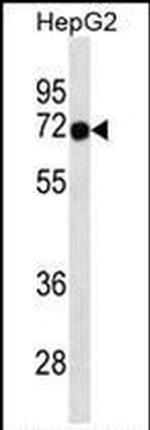 FOXN3 Antibody in Western Blot (WB)