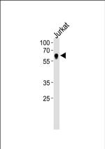 NR2C2 Antibody in Western Blot (WB)