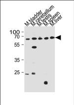 ZNF654 Antibody in Western Blot (WB)