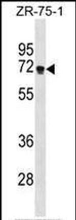 ZNF654 Antibody in Western Blot (WB)