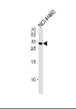 ASCL1 Polyclonal Antibody