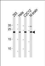 HIP2 Antibody in Western Blot (WB)