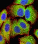 NFkB p65 Antibody in Immunocytochemistry (ICC/IF)