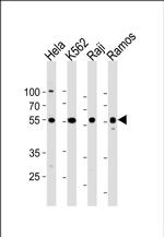 NFkB p65 Antibody in Western Blot (WB)