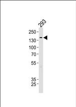 TSC2 Antibody in Western Blot (WB)