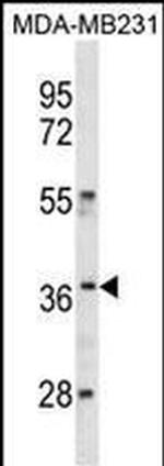 HOXC10 Antibody in Western Blot (WB)