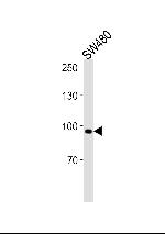 ANO6 Polyclonal Antibody