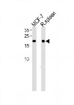 ZNF9 Antibody in Western Blot (WB)