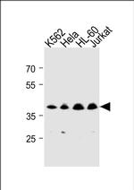 MECR Antibody in Western Blot (WB)