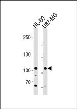 MORC3 Antibody in Western Blot (WB)