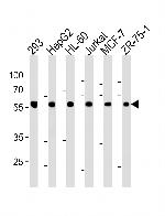 ZRSR2 Antibody in Western Blot (WB)