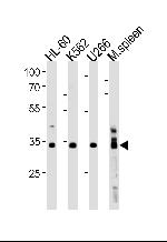 GFI1B Polyclonal Antibody