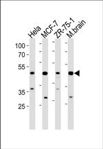 FBXO28 Antibody in Western Blot (WB)