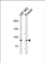 SEMA6B Antibody in Western Blot (WB)