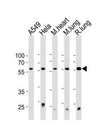 PSMC1 Antibody in Western Blot (WB)