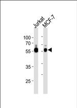 ZNF434 Antibody in Western Blot (WB)