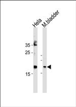 FAM159A Antibody in Western Blot (WB)