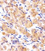 RPLP0P6 Antibody in Immunohistochemistry (Paraffin) (IHC (P))