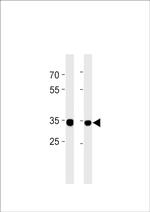 RPLP0P6 Antibody in Western Blot (WB)
