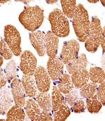 SIRPB1 Polyclonal Antibody