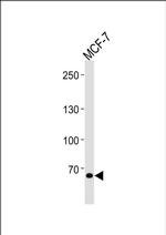 TSPYL2 Antibody in Western Blot (WB)