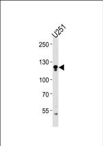 ECE2 Antibody in Western Blot (WB)