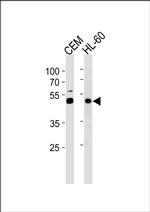 BLMH Antibody in Western Blot (WB)
