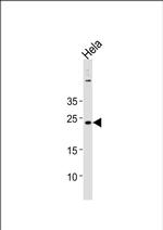 CNO Antibody in Western Blot (WB)