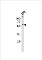 ZNF76 Antibody in Western Blot (WB)