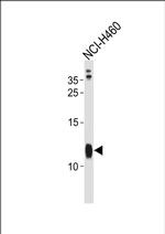 RPS21 Antibody in Western Blot (WB)