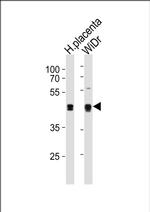 SAP30BP Antibody in Western Blot (WB)