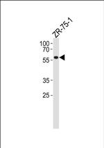PPP2R2A Antibody in Western Blot (WB)