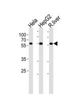POLD2 Antibody in Western Blot (WB)