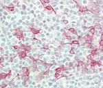 Interferon alpha-4 Polyclonal Antibody